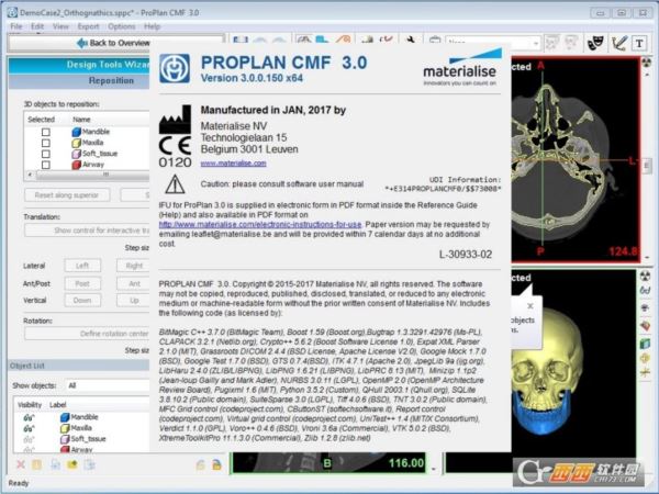 医疗手术模拟软件Materialise ProPlan CMF
